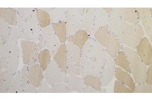 Human skeletal muscle: immunohistochemical staining for Myotilin. (Myotilin Antikörper  (C-Term))