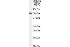 Western Blotting (WB) image for Fatty Acid Desaturase 1 (FADS1) peptide (ABIN369682) (Fatty Acid Desaturase 1 (FADS1) Peptid)