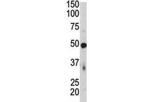 Western blot of PDK4 antibody and mouse skeletal muscle tissue lysate. (PDK4 Antikörper  (AA 382-410))