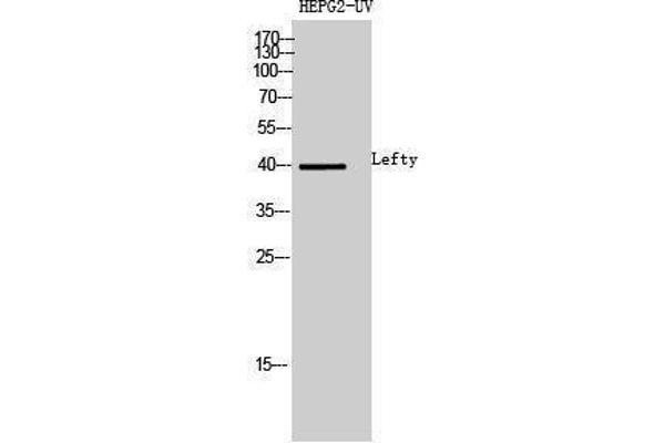 LEFTY1 Antikörper  (Internal Region)