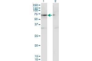 Western Blot analysis of CD44 expression in transfected 293T cell line by CD44 monoclonal antibody (M13), clone 4D2. (CD44 Antikörper  (AA 1-699))