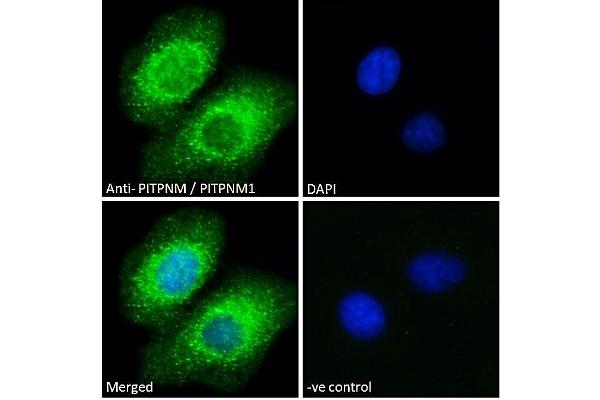 PITPNM1 Antikörper  (C-Term)