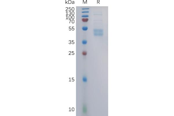CCR6 Protein (AA 1-47) (mFc Tag)