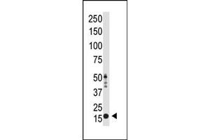 Image no. 1 for anti-Histone 3 (H3) (H3K9me2) antibody (ABIN356586) (Histone 3 Antikörper  (H3K9me2))