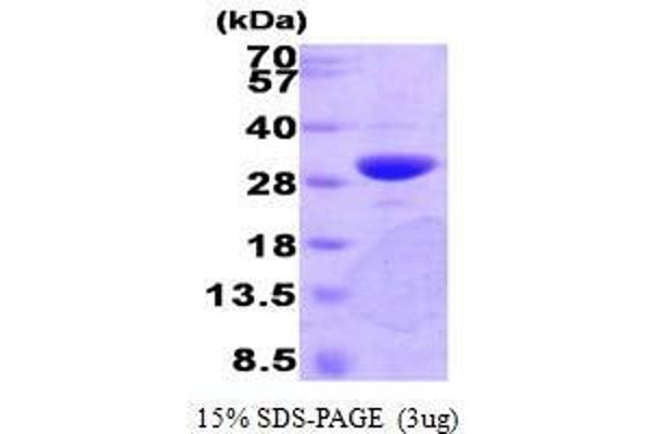 PNMT Protein (AA 1-282)