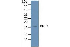 Detection of UBE2C in Human Hela Cells using Polyclonal Antibody to Ubiquitin Conjugating Enzyme E2C (UBE2C) (UBE2C Antikörper  (AA 2-179))