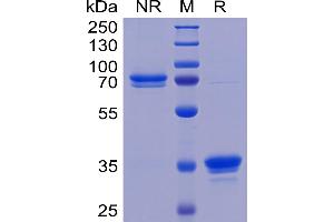 Human TweakR Protein, mFc Tag on SDS-PAGE under non-reducing (NR) and reducing (R) conditions. (TNFRSF12A Protein (AA 28-80) (mFc Tag))