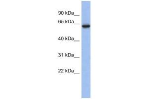 CACNB2 antibody used at 1 ug/ml to detect target protein. (CACNB2 Antikörper  (Middle Region))