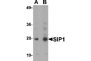 Western Blotting (WB) image for anti-Gem (Nuclear Organelle) Associated Protein 2 (GEMIN2) (C-Term) antibody (ABIN1030662) (SIP1 Antikörper  (C-Term))