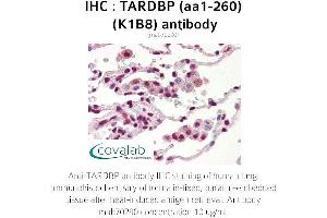 Image no. 3 for anti-TAR DNA Binding Protein (TARDBP) (AA 1-260) antibody (ABIN1723216) (TARDBP Antikörper  (AA 1-260))