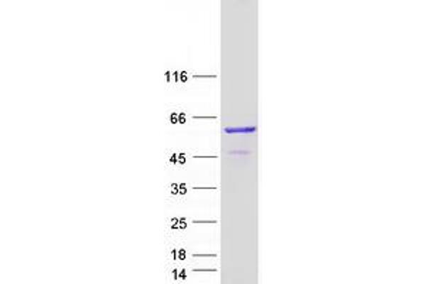 TBCE Protein (Transcript Variant 1) (Myc-DYKDDDDK Tag)