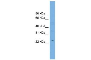 MBL2 antibody used at 1 ug/ml to detect target protein. (MBL2 Antikörper  (Middle Region))