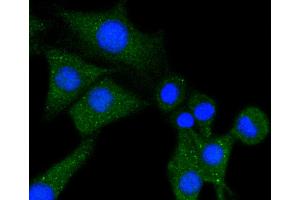 SHG-44 cells were stained with Phospholipase C gamma 1 (85F11) Monoclonal Antibody  at [1:200] incubated overnight at 4C, followed by secondary antibody incubation, DAPI staining of the nuclei and detection. (Phospholipase C gamma 1 Antikörper)