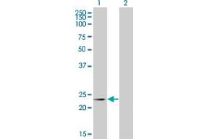 Western Blot analysis of RCV1 expression in transfected 293T cell line by RCV1 monoclonal antibody (M08), clone 4C10. (Recoverin Antikörper  (AA 101-199))