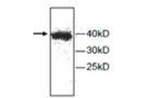 Image no. 1 for anti-Cathepsin H (CTSH) antibody (ABIN791523) (Cathepsin H Antikörper)