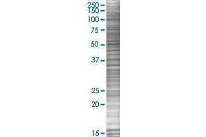 C20orf70 transfected lysate. (C20orf70 293T Cell Transient Overexpression Lysate(Denatured))