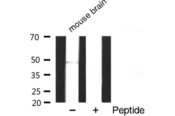 HDAC3 Antikörper  (C-Term)