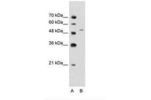 Image no. 2 for anti-Nicotinamide phosphoribosyltransferase (NAMPT) (C-Term) antibody (ABIN203416) (NAMPT Antikörper  (C-Term))