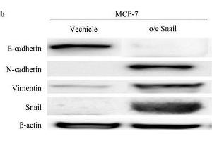 Western Blotting (WB) image for anti-Vimentin (VIM) antibody (ABIN2854814)