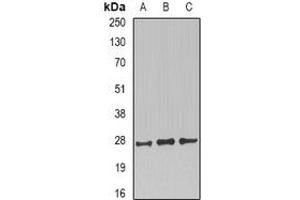 Western blot analysis of CD230 expression in SKOV3 (A), mouse brain (B), mouse kidney (C) whole cell lysates. (PRNP Antikörper)