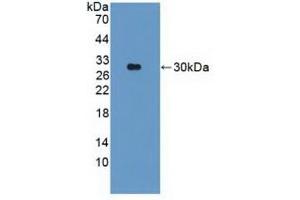 Detection of Recombinant PARK2, Human using Polyclonal Antibody to Parkinson Disease Protein 2 (PARK2) (Parkin Antikörper  (AA 229-465))