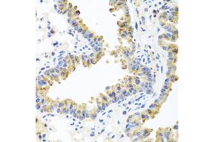 Immunohistochemistry of paraffin-embedded mouse lung using HSPA6 antibody. (HSPA6 Antikörper)