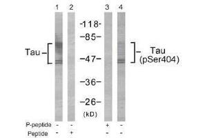 Image no. 1 for anti-Microtubule-Associated Protein tau (MAPT) (Ser404) antibody (ABIN197270) (MAPT Antikörper  (Ser404))