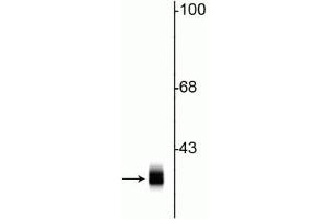 Western blot of rat cortical lysate showing specific immunolabeling of the ~ 36 kDa syntaxin 1A protein. (STX1A Antikörper)