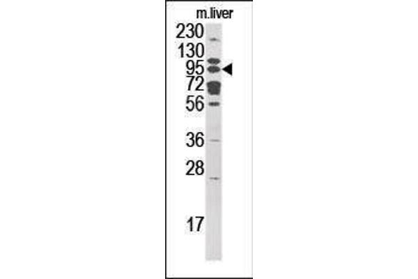 GCS1 Antikörper  (C-Term)