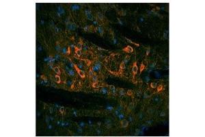 TH antibody used at a concentration of 10 ug/ml to detect substantia nigra and solitary tract in rodent brain (red). (TH Antikörper  (N-Term))