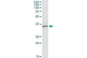 BDH1 monoclonal antibody (M03), clone 4B3. (BDH1 Antikörper  (AA 1-343))