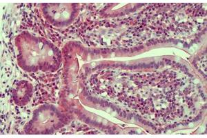 Human Small Intestine: Formalin-Fixed, Paraffin-Embedded (FFPE) (Claudin 2 Antikörper  (AA 135-164))