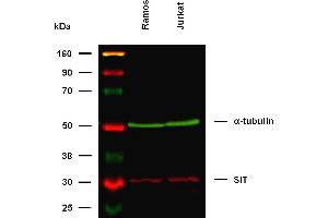 Western Blotting (WB) image for anti-Signaling threshold Regulating Transmembrane Adaptor 1 (SIT1) antibody (ABIN94465)