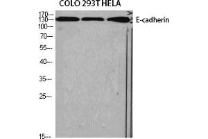 Western Blot analysis of various cells using E-cadherin Polyclonal Antibody diluted at 1:1000. (E-cadherin Antikörper  (AA 1-80))