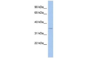 MAGEA9 antibody used at 0. (MAGEA9 Antikörper  (Middle Region))