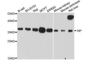 Western blot analysis of extracts of various cell lines, using AIP antibody. (AIP Antikörper  (AA 1-330))