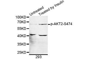 Western blot analysis of extracts of 293 cells, using Phospho-AKT2-S474 antibody (ABIN5969868). (AKT2 Antikörper  (pSer474))
