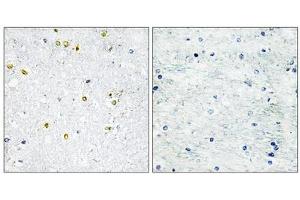 Immunohistochemistry analysis of paraffin-embedded human brain tissue using TRIM24 antibody. (TRIM24 Antikörper  (C-Term))