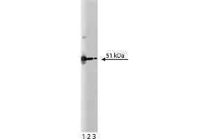 Western Blotting (WB) image for anti-PKA RIIalpha (AA 1-404) antibody (ABIN968784) (PKA RIIalpha (AA 1-404) Antikörper)