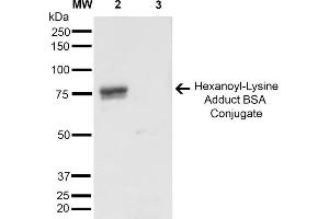 Western Blot analysis of Hexanoyl Lysine-BSA Conjugate showing detection of 67 kDa Hexanoyl-Lysine adduct-BSA using Mouse Anti-Hexanoyl-Lysine adduct Monoclonal Antibody, Clone 5D9 . (Hexanoyl-Lysine Adduct (HEL) Antikörper (Atto 594))