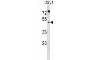 Western Blotting (WB) image for anti-Integrin-Linked Kinase-Associated Serine/threonine Phosphatase 2C (ILKAP) antibody (ABIN3000918) (ILKAP Antikörper)