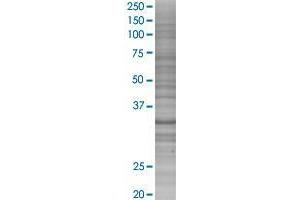 ZC3H14 transfected lysate. (ZC3H14 293T Cell Transient Overexpression Lysate(Denatured))