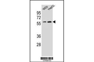 Western blot analysis in WiDr,HepG2 cell line lysates (35ug/lane). (HOXA10 Antikörper  (AA 244-271))