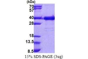 TTC35 Protein (AA 1-297) (His tag)