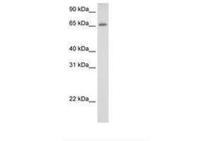 Image no. 2 for anti-Adenosine Deaminase, tRNA-Specific 1 (ADAT1) (C-Term) antibody (ABIN6736282) (ADAT1 Antikörper  (C-Term))