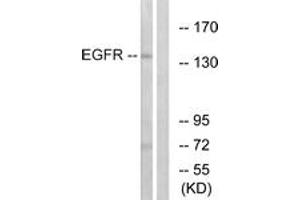 Western blot analysis of extracts from A431 cells, treated with EGF 40myM 10', using EGFR (Ab-1197) Antibody. (EGFR Antikörper  (AA 1161-1210))