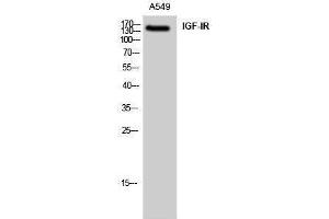 Western Blotting (WB) image for anti-Insulin-Like Growth Factor 1 Receptor (IGF1R) (Ser528) antibody (ABIN6281126) (IGF1R Antikörper  (Ser528))