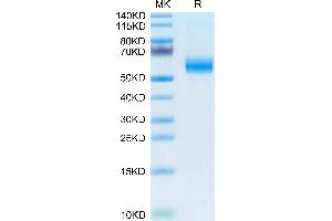 Mouse PLA2G7 on Tris-Bis PAGE under reduced condition. (PLA2G7 Protein (AA 22-440) (His tag))