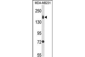 Western blot analysis of ITGA2 Antibody in MDA-MB231 cell line lysates (35ug/lane) (ITGA2 Antikörper  (C-Term))
