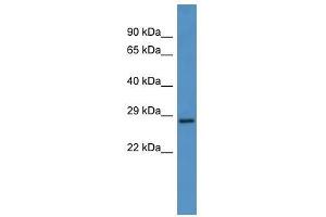 Western Blot showing CEACAM7 antibody used at a concentration of 1-2 ug/ml to detect its target protein. (CEACAM7 Antikörper  (N-Term))